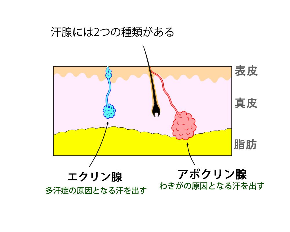 ワキ汗 ニオイの切らない治療 ミラドライ 大好評です 東京プラチナムクリニック